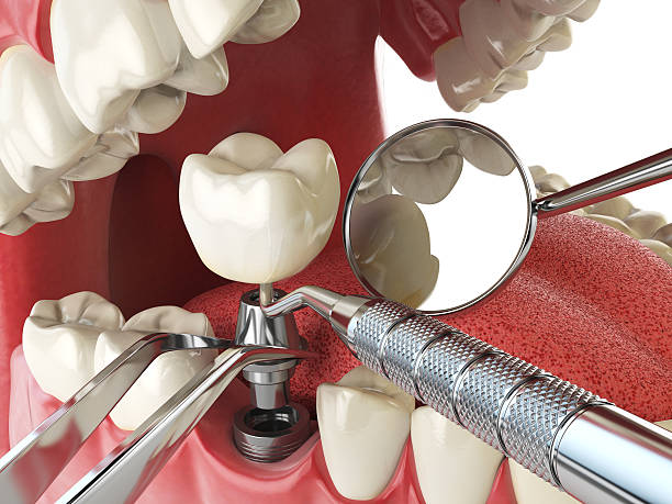 Best Emergency Cosmetic Dentistry in Blasdell, NY