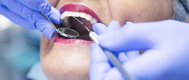Best Emergency Dental Services for Seniors in Blasdell, NY